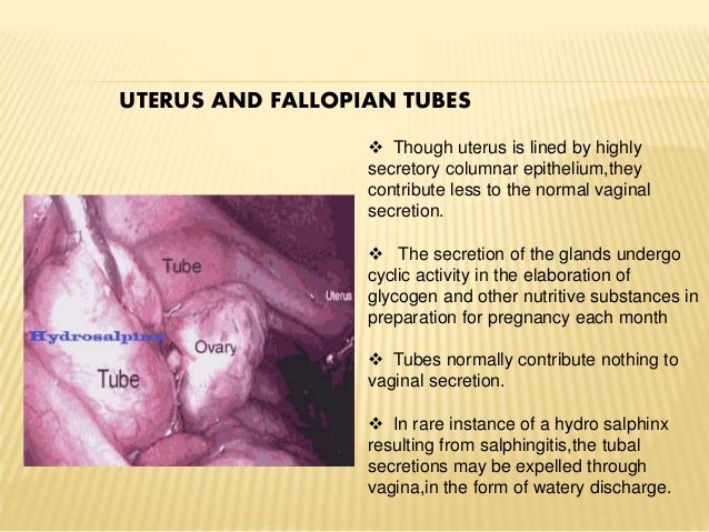 normal excessive vaginal discharge Femdom 3 video